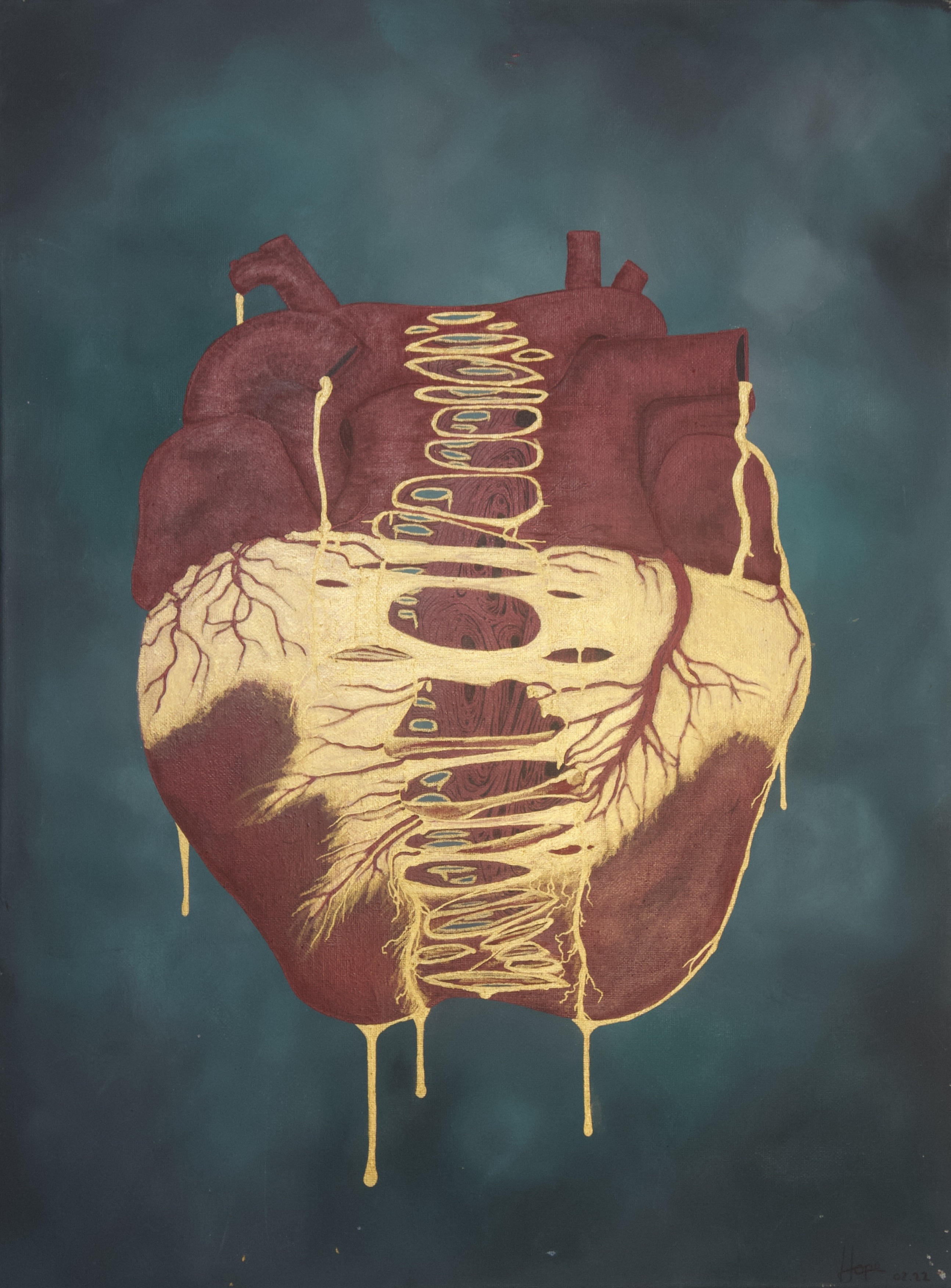 Heart of Gold artwork